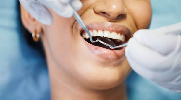 Best Weekend Emergency Dentist in Alameda, CA